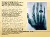 Рентгеновские лучи. Открытие рентгеновского излучения приписывается Вильгельму Конраду Рентгену. Он был первым, кто опубликовал статью о рентгеновских лучах, которые он назвал икс-лучами (x-ray). Статья Рентгена под названием «О новом типе лучей» была опубликована 28-го декабря 1895 года в журнале В