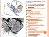 Срединный сагиттальный разрез мозжечка. a - схематическое изображение; б - фотография макропрепарата. 1 - мост (pons) ; 2 - продолговатый мозг (medulla oblongata) ; 3 - полушарие мозжечка (hemispherium cerebelli) ; 4 - IV желудочек (ventriculus quartus) ; 5 - затылочная доля конечного мозга (lobus o
