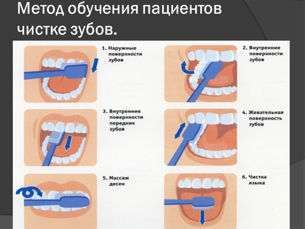 Этапы гигиены полости рта. Правильная методика чистки зубов зубной щёткой. Методы чистки зубов стандартный метод. Стандартный метод чистки зубов схема. Методы чистки зубов: стандартный метод чистки.