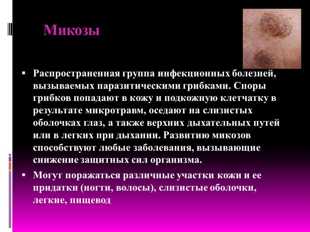 К грибковым заболеваниям кожи относятся. Сообщение о болезнях кожи биология 8. Доклад грибковые заболевания кожи. Грибковая кожная инфекция.