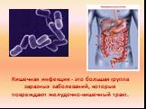 Кишечная инфекция - это большая группа заразных заболеваний, которые повреждают желудочно-кишечный тракт.