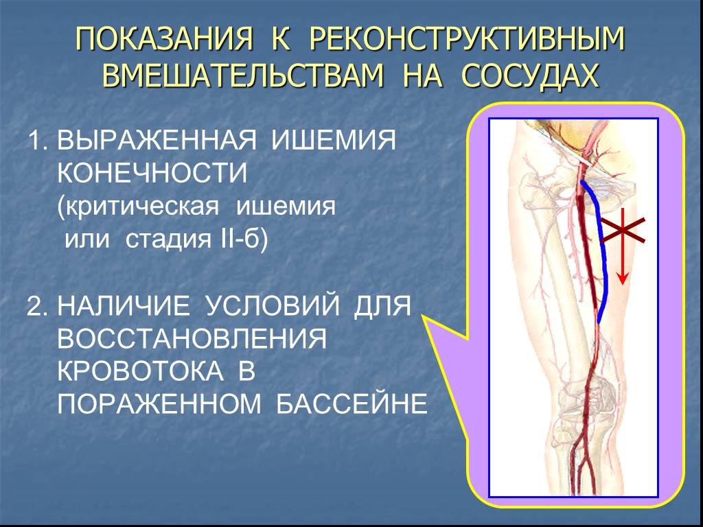 Артерия ноги операция. Реконструктивные операции на артериях. Показания к операциям на артериях.. Показания к операции на сосудах. Артерии нижней конечности.