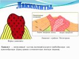 Лакколиты. Лакколит — интрузивный массив, имеющий в разрезе грибообразную или куполообразную форму кровли и относительно плоскую подошву. Лакколит в районе Пятигорска. Форма лакколита.