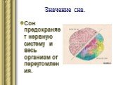 Значение сна. Сон предохраняет нервную систему и весь организм от переутомления.