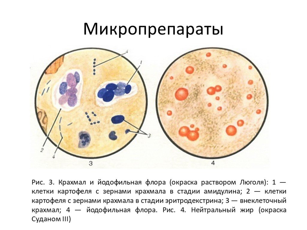 Бактерии в копрограмме. Копрология кала микроскопия. Микроскопия кала люголь.