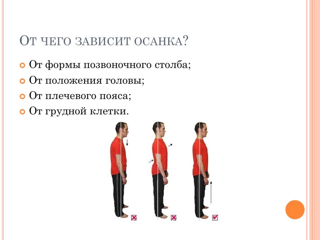 Нарушение осанки и плоскостопие презентация 8 класс биология