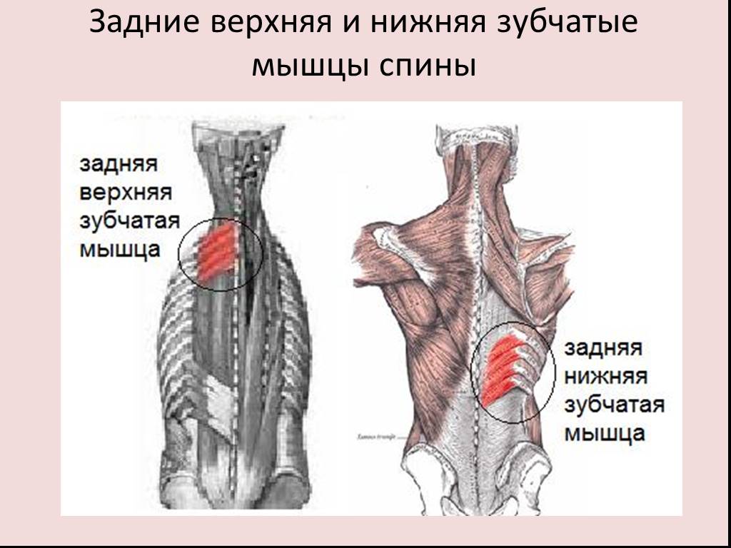 Мышцы спины и ребра. Верхняя и нижняя задняя зубчатая мышца. Задняя зубчатая мышца спины. Верхняя задняя зубчатая мышца спины. Нижняя задняя зубчатая мышца иннервация.