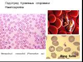 Подотряд Кровяные споровики Haemosporina. Малярийный плазмодий (Plasmodium sp.)