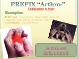 PREFIX “Arthro-” Indicating a joint Examples: Arthropod - a invertebrate having jointed limbs and a segmented body with an exoskeleton made of chitin. Arthropathy - any joint disease Ar thro pod Ar th r o p o d