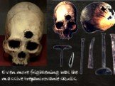 Even more frightening was the massive trepanirovanie skulls.