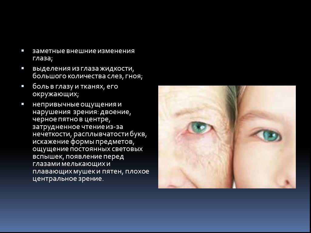Есть незначительные изменения. Возрастные изменения органа зрения. Старческие изменения глаза. Возрастные изменения органа зрения у пожилых людей. Старение органа зрения характеризуется.