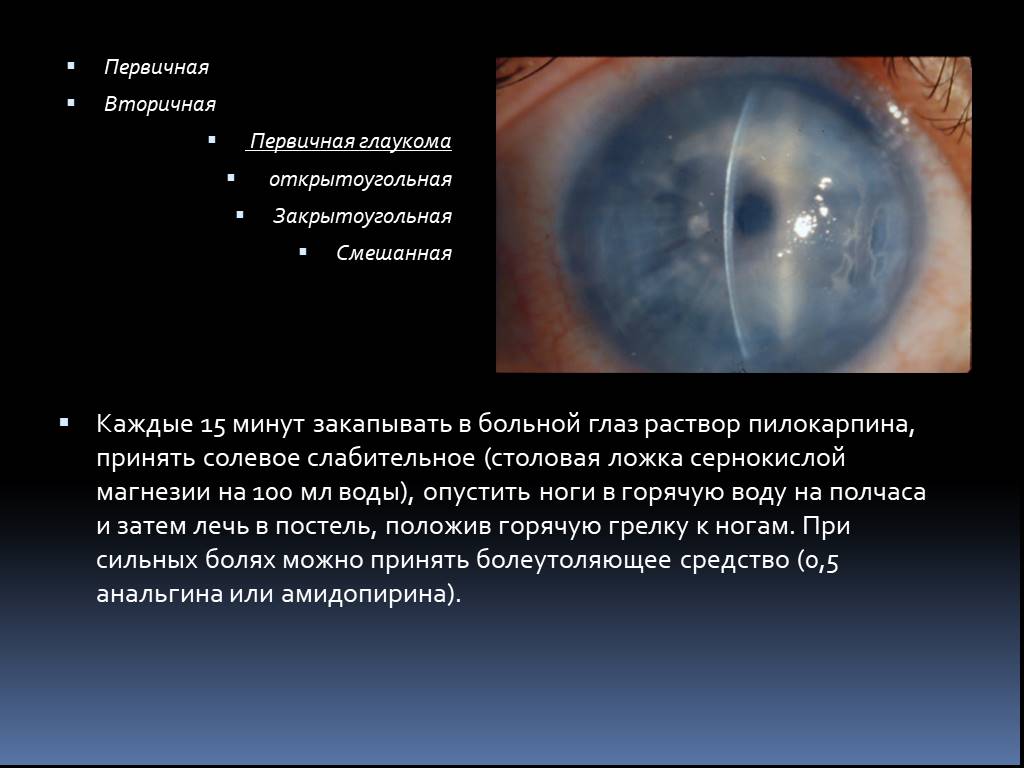 Для открытоугольной глаукомы характерны тест. Вторичная факолитическая глаукома. Факотопическая глаукома. Вторичная открытоугольная глаукома. Первичная открытоугольная глаукома.