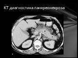 КТ диагностика панкреонекроза