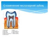 1) изменение числа корней зубов;