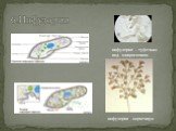 6.Инфузории. инфузория – туфелька под микроскопом. инфузория - кархезиум