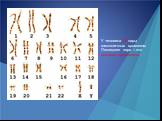 У человека 23 пары гомологичных хромосом Последняя пара – это половые хромосомы