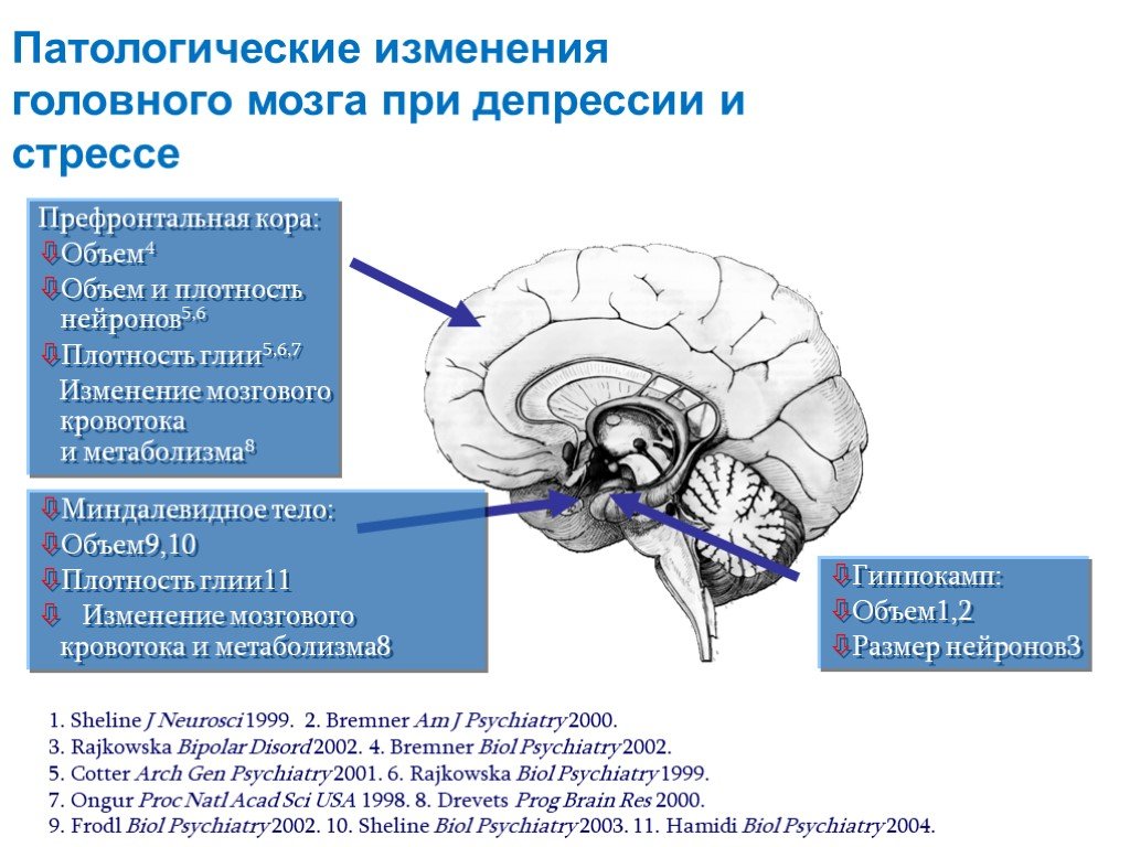 Внутренние признаки головного мозга. Изменение структуры мозга. Изменения в мозге при депрессии. Процессы головного мозга. Процессы которые происходят в головном мозге.