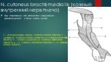 N. cutaneus brachii media1is (кожный внутренний нерв плеча). При поражении его возникают нарушения чувствительности и боли в зоне плеча. I — подкрыльцовый нерв (n. cutaneus brachii lateralis); 2 — луче­вой (n. cutaneus brachii posterior и n. cutaneus antibrachii dorsalis); 3 — кожно-мышечный (n. cut