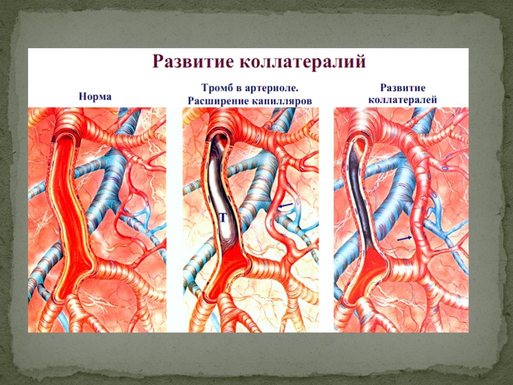 Нарушение периферического венозного кровообращения