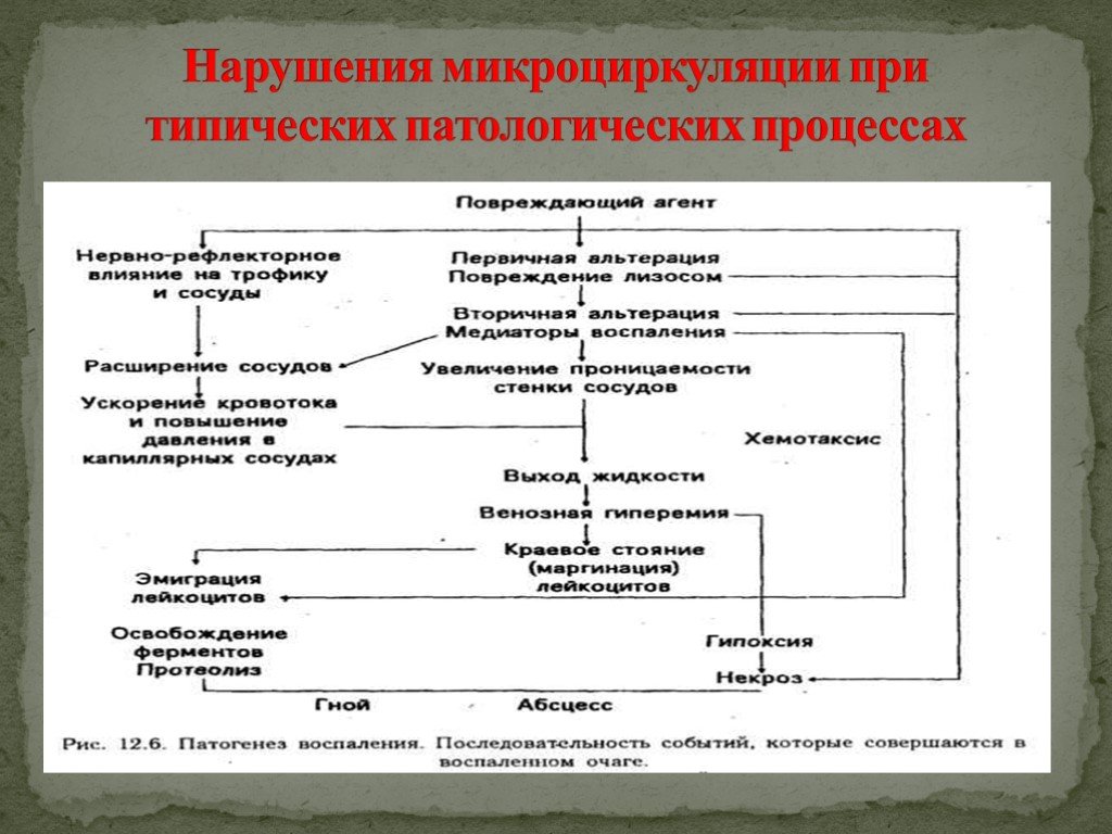 Схема нарушения кровообращения