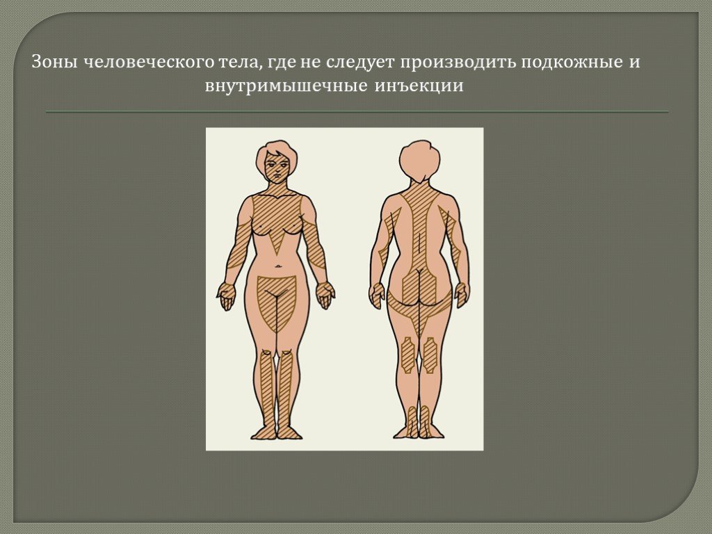 Отметьте на рисунке и напишите места для внутримышечных инъекций