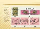 Схематическое изображение круговых швов: а — серкляж — скрепление костных отломков при косом переломе кости; б — блоковый полиспастный шов для сближения ребер; в — простой кисетный шов; г — S-образный кисетный шов по Русанову; д — Z-образный кисетный шов по Салтену.