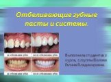 Отбеливающие зубные пасты и системы. Выполнила студентка 2 курса, 5 группы Волова Галина Владимировна.