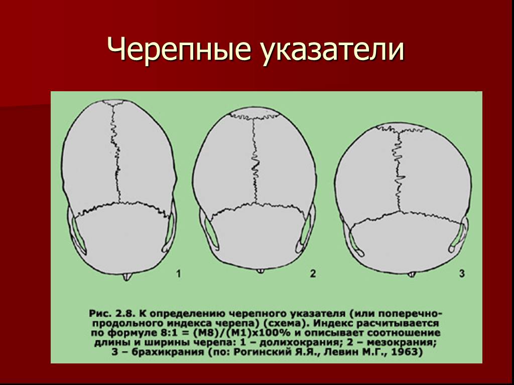 Варианты формы черепа. Формы черепа человека. Виды форм черепа. Разные формы черепа у людей.