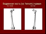 Бедренная кость (os femoris) правая вид спереди вид сзади