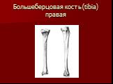 Большеберцовая кость (tibia) правая