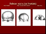 Лобная кость (os frontale) вид спереди вид с внутренней стороны вид снизу