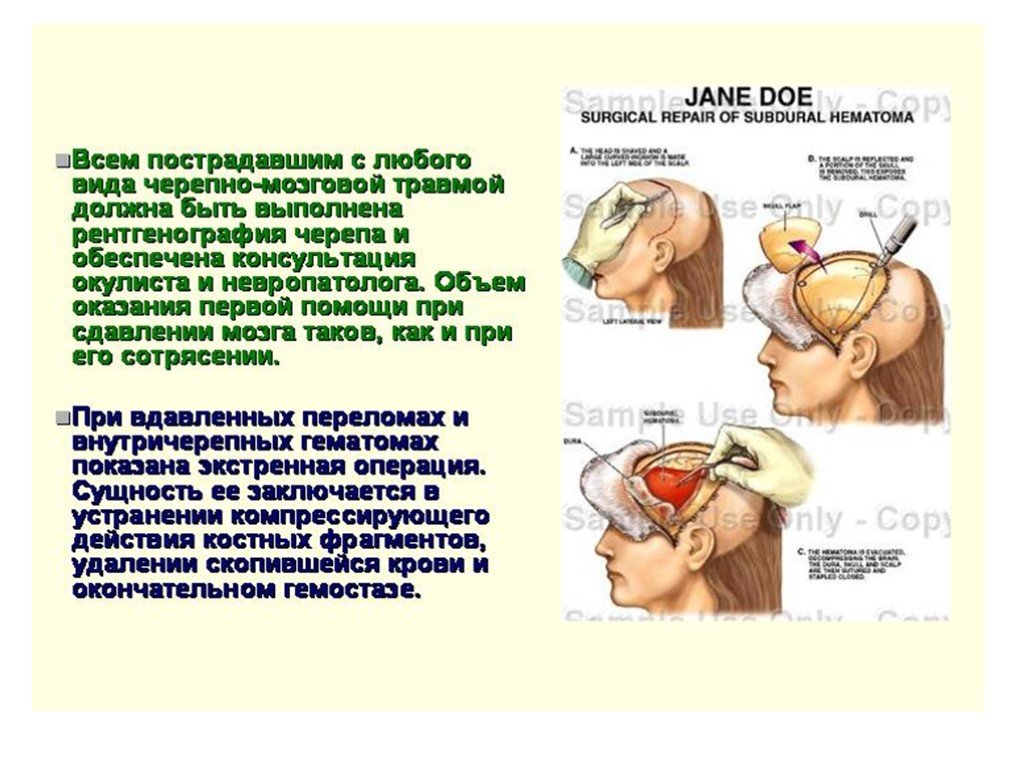 Черепно мозговая травма медицинская помощь. При черепно-мозговой травме:. Рвота при черепно мозговой травме. Закрытая черепно-мозговая травма первая помощь. Открытые и закрытые черепно мозговые травмы.