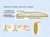 Нервная система у кольчатых червей: 1)диффузная; 2)цепочечная; 3)узловая; 4) лестничная