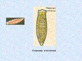 Стволовая (лестничная)