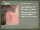 Симптоматика Ушная раковина является рудиментарной, т.е. выглядит как зачаток нормального уха. Отсутствует наружный слуховой проход и барабанная перепонка. III степень