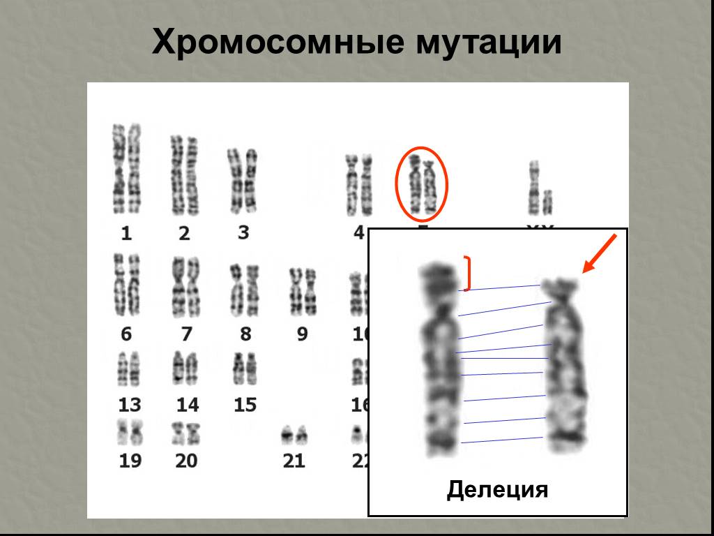 Изменение формы хромосом