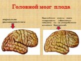 Головной мозг плода. нормально развивающегося. Важнейшие отделы мозга недоразвиты (обозначены точками) из –за употребления алкоголя беременной.