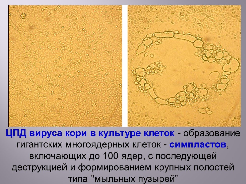 Цпд это микробиология