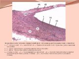 Бедренная вена человека (продольный срез) с сильным развитием мышечных элементов 1 — f. intima и в ней: 1А — эндотелий, 1Б — подэндотелиальный слой с продольно расположенными миоцитами. 2 — f. media: циркулярно ориентированные пучки миоцитов. 3 — t. externa: продольно расположенные миоциты. 4— клапа