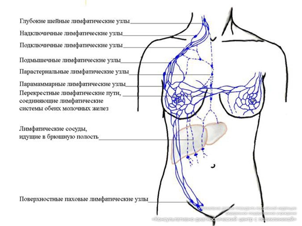 Лимфатические узлы груди. Аксиллярные лимфоузлы в молочной железе что это такое. Лимфатическая система молочной железы топографическая анатомия. Лимфоузлы аксиллярной области молочной железы. Лимфатические узлы молочной железы схема.