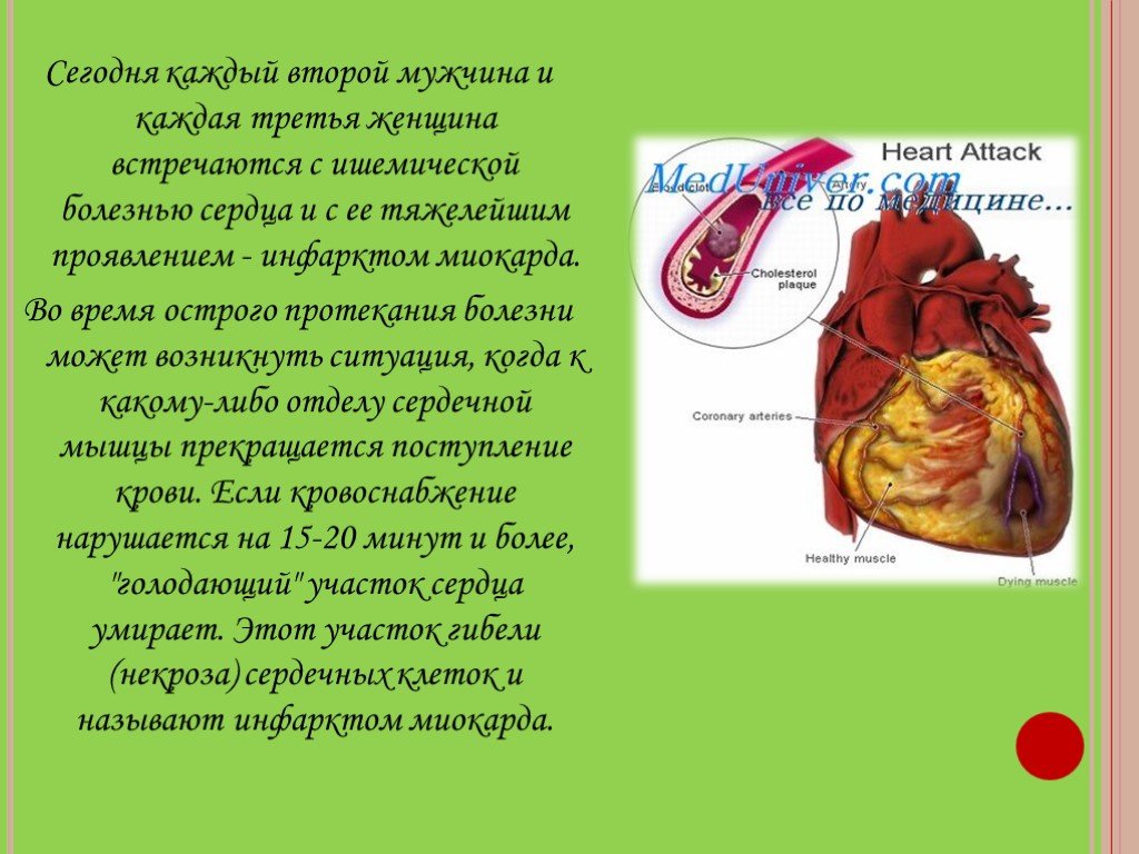 Сколько живут с ишемией. Презентация на тему ишемическая болезнь сердца 8 класс. Сколько живут с ишемией сердца. Инфаркт проект по биологии.