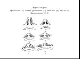 Форма ноздрей: продольная (1), слегка удлиненная (2), овальная (3), кругла (4), фасолевидная (5, 6)