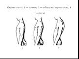 Форма спины; 1 — прямая, 2 — обычная (нормальная), 3 — сутулая