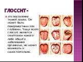 Глоссит -. это воспаление тканей языка. Он может быть поверхностным или глубоким. Чаще всего глоссит является симптомом какого-либо общего заболевания организма, но может возникать и самостоятельно.