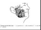 Границы щечной области (А): 1 — os zygomaticum, 2 — corpus mandibulae, 3 — m. masseter, 4 — glandula