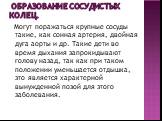 Образование сосудистых колец. Могут поражаться крупные сосуды такие, как сонная артерия, двойная дуга аорты и др. Такие дети во время дыхания запрокидывают голову назад, так как при таком положении уменьшается отдышка, это является характерной вынужденной позой для этого заболевания.