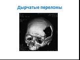Переломы костей черепа Слайд: 19