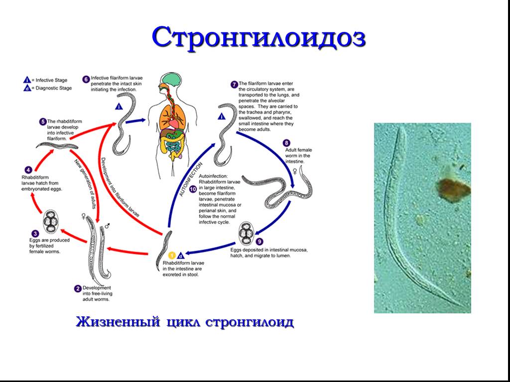 Жизненный цикл угрицы. Цикл развития угрицы кишечной. Угрица кишечная цикл развития. Жизненный цикл угрицы кишечной. Жизненный цикл угрицы кишечной схема.