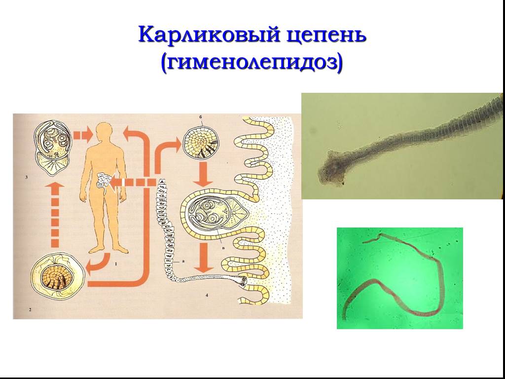 Карликовый цепень строение. Карликовый цепень (Hymenolepis Nana). Карликовый цепень паразитология. Ленточные черви паразиты карликовый цепень. Карликовый цепень, возбудитель гименолепидоза.
