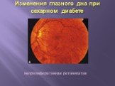 Изменения глазного дна при сахарном диабете. непролиферативная ретинопатия